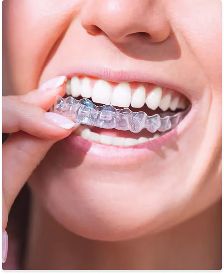 A clear aligner tray