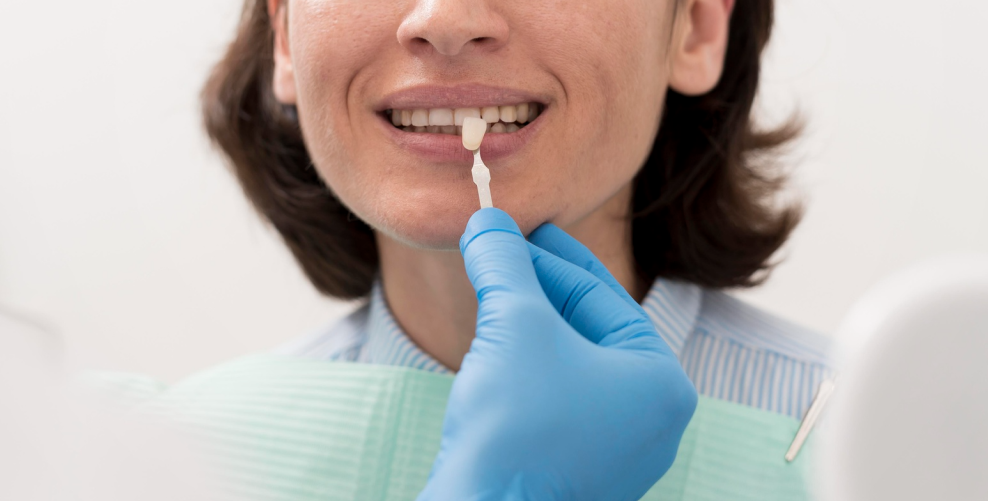 How to Care for a Dental Crown and Help It Last