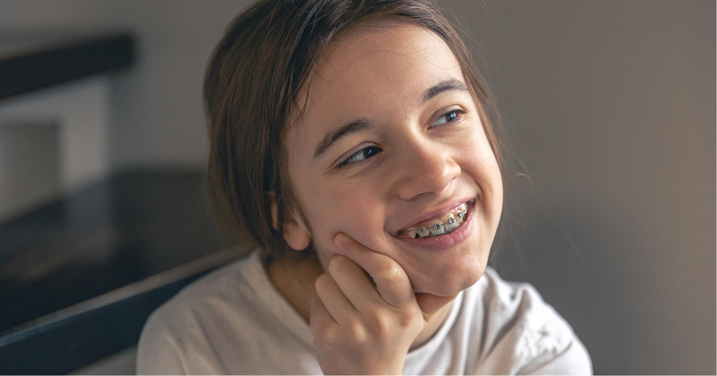 Types of Braces We Offer
