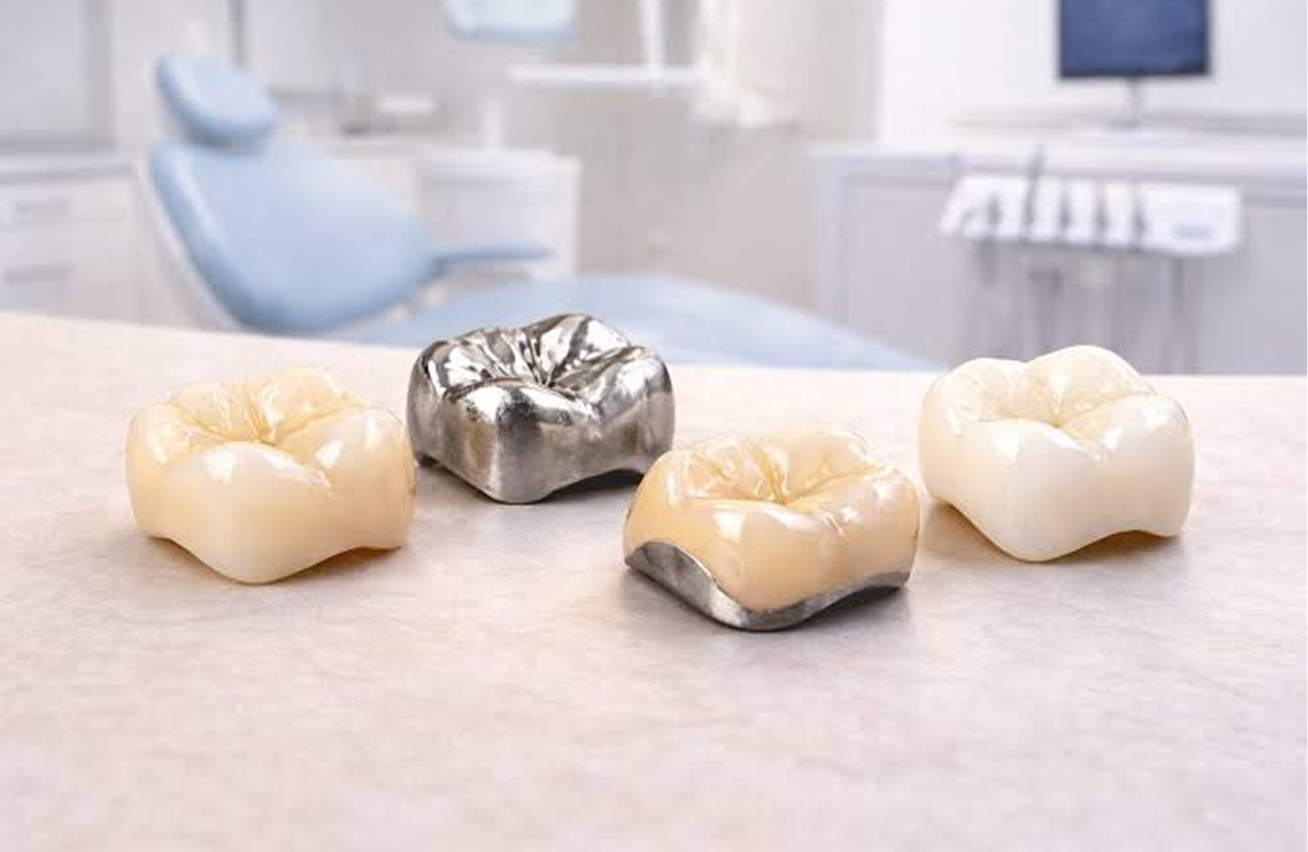 Types of Crowns We Offer