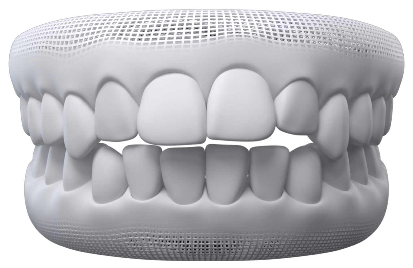 Dental model showing an open bite
